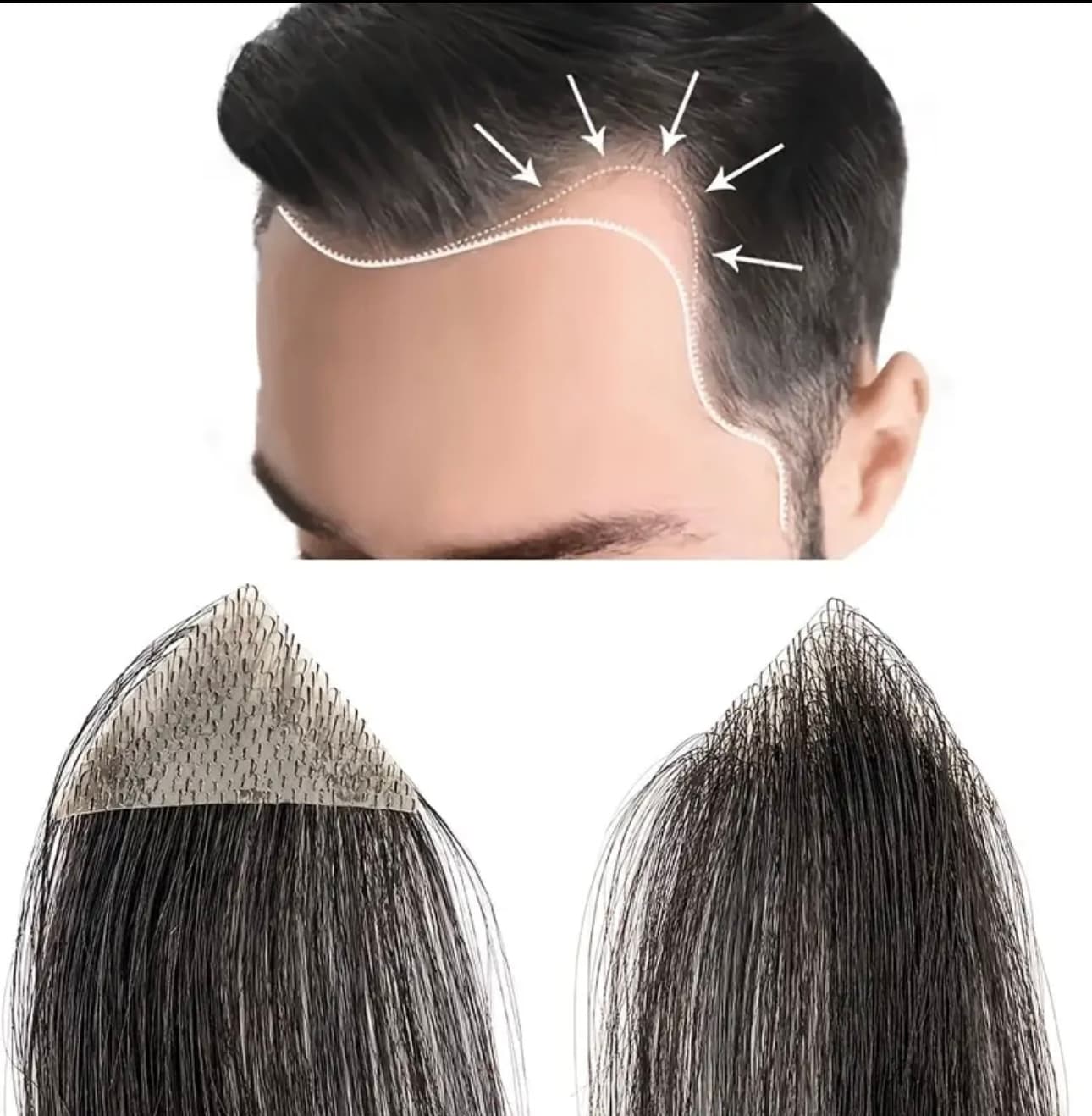 Mesa Adeziva pentru Alopecie